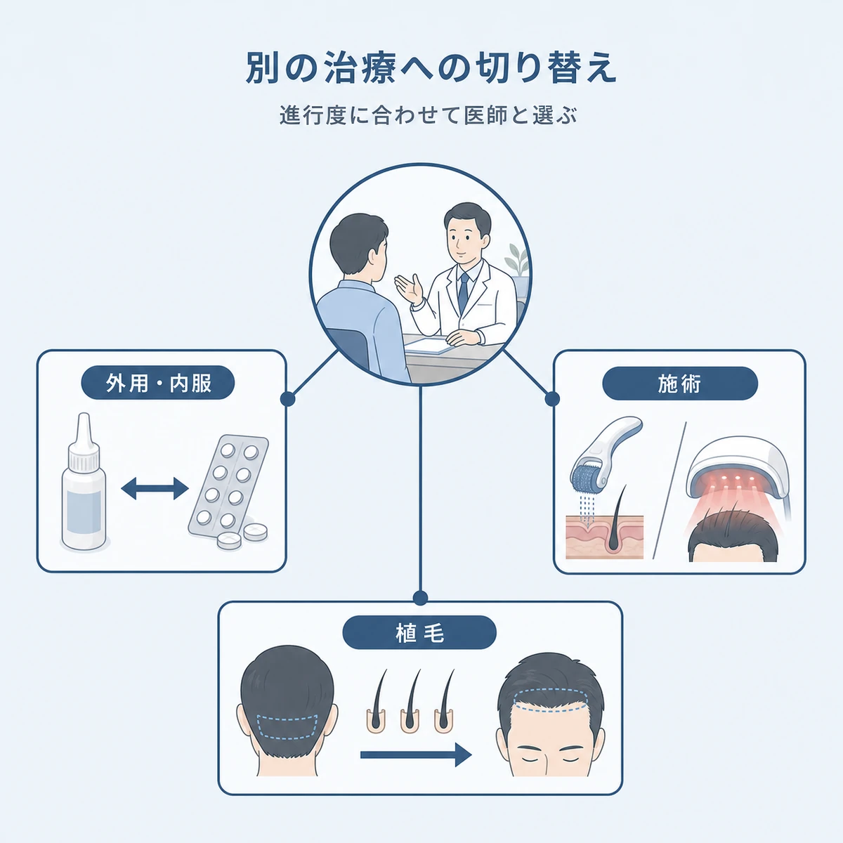外用と内服の切り替えや施術や植毛など育毛剤中止後に検討する治療の選択肢を放射状に並べた医療イラスト