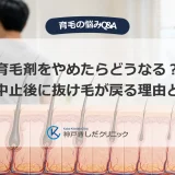 育毛剤をやめたらどうなる？使用中止後に抜け毛が戻る理由と対策