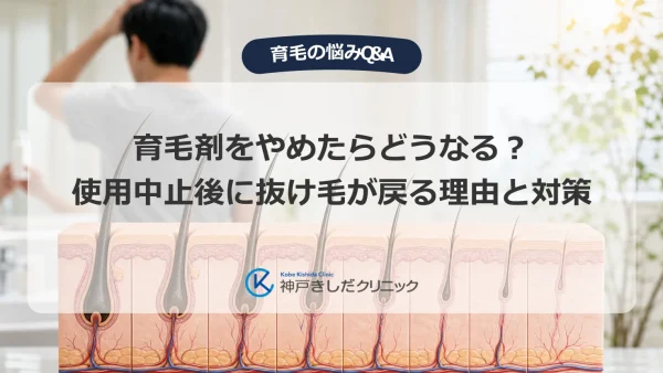 育毛剤をやめたらどうなる？使用中止後に抜け毛が戻る理由と対策