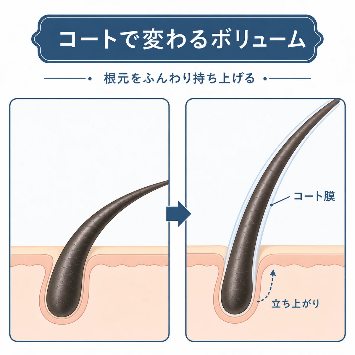 コート膜で根元が立ち上がるボリュームケアの働きを前後で比べた医療イラスト