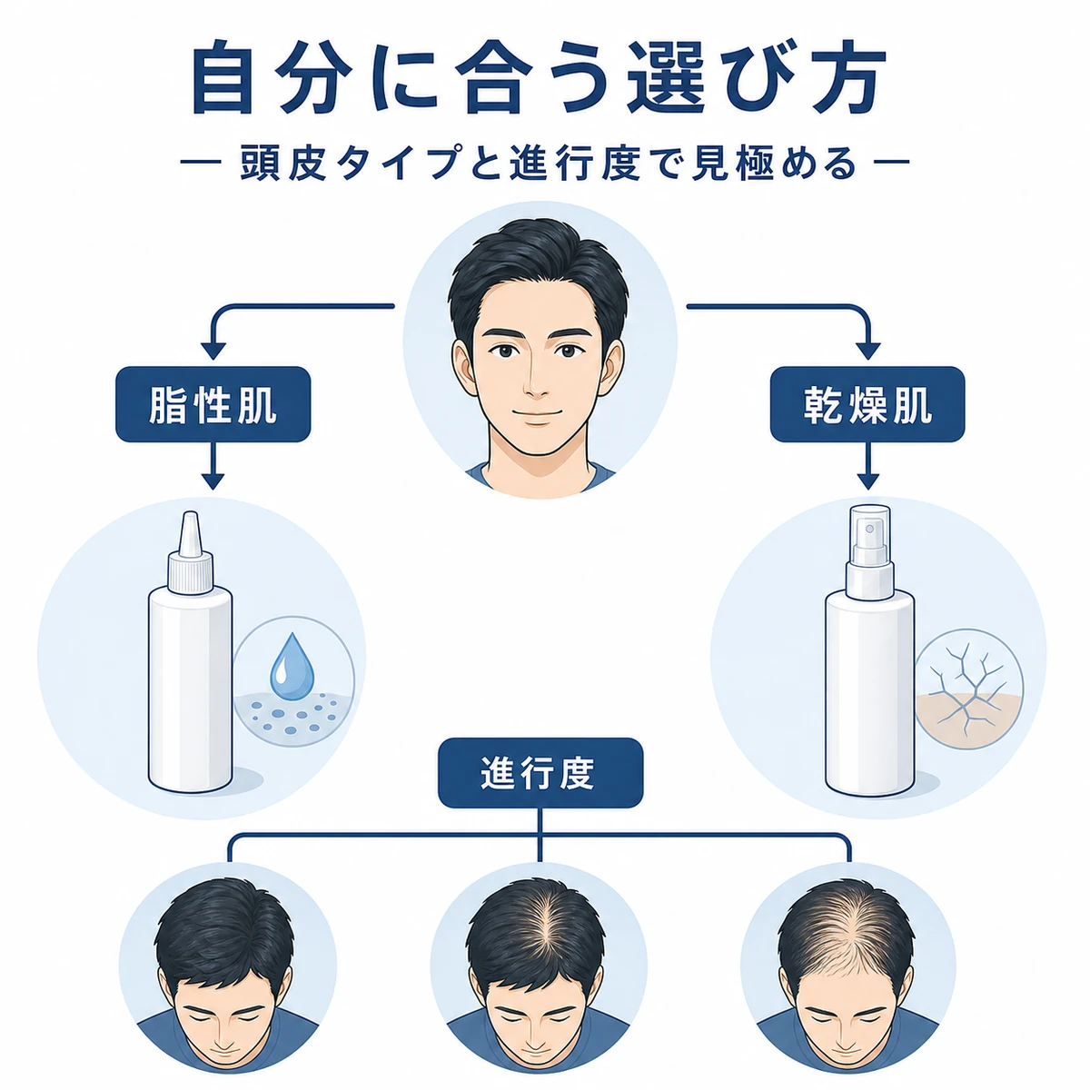 頭皮タイプと進行度に応じた育毛剤の選び方を表した医療イラスト