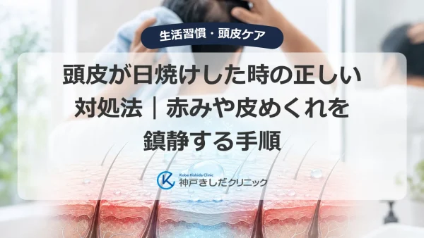 頭皮が日焼けした時の正しい対処法｜赤みや皮めくれを鎮静する手順