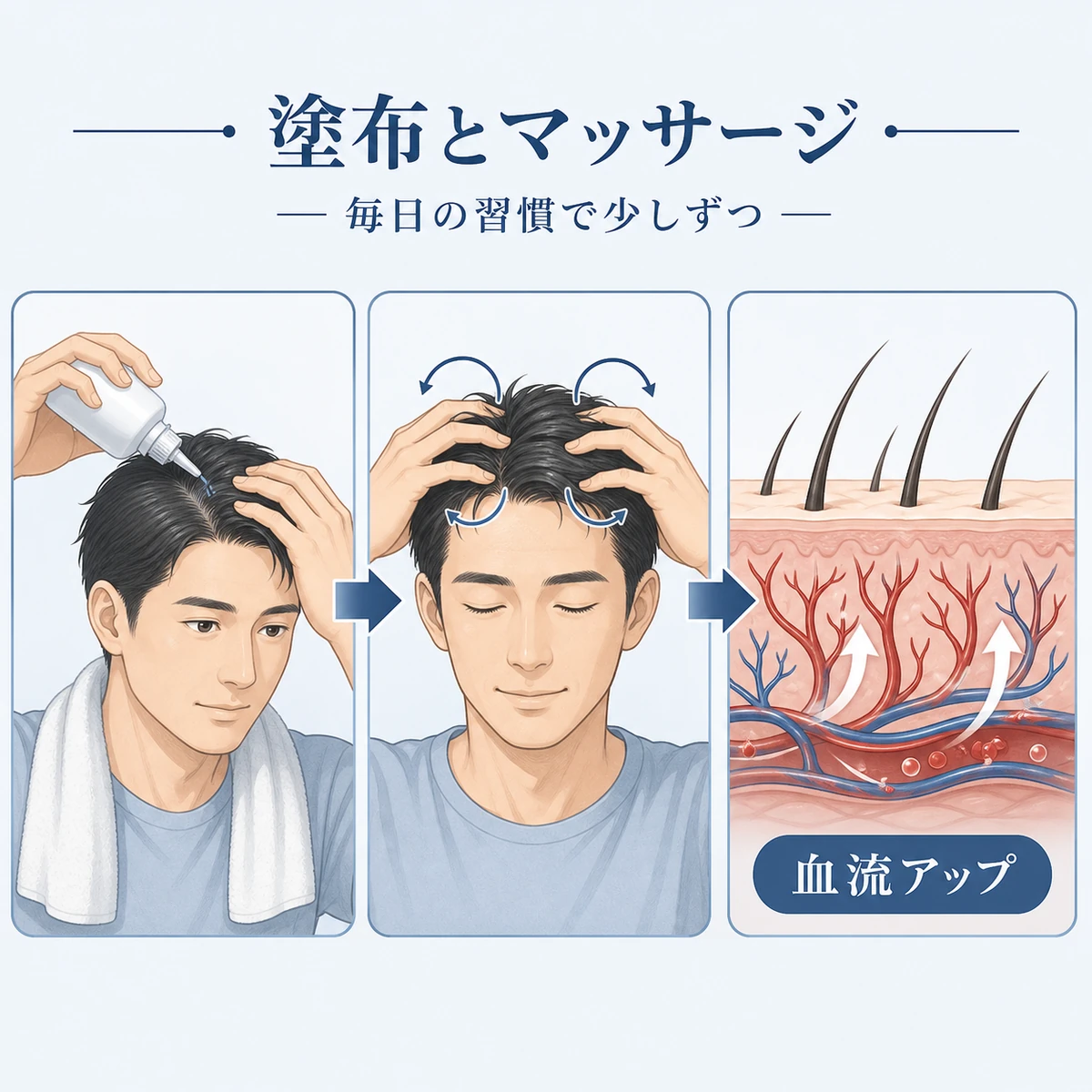 育毛剤の塗布から頭皮マッサージ、血流アップまでの手順を表した医療イラスト