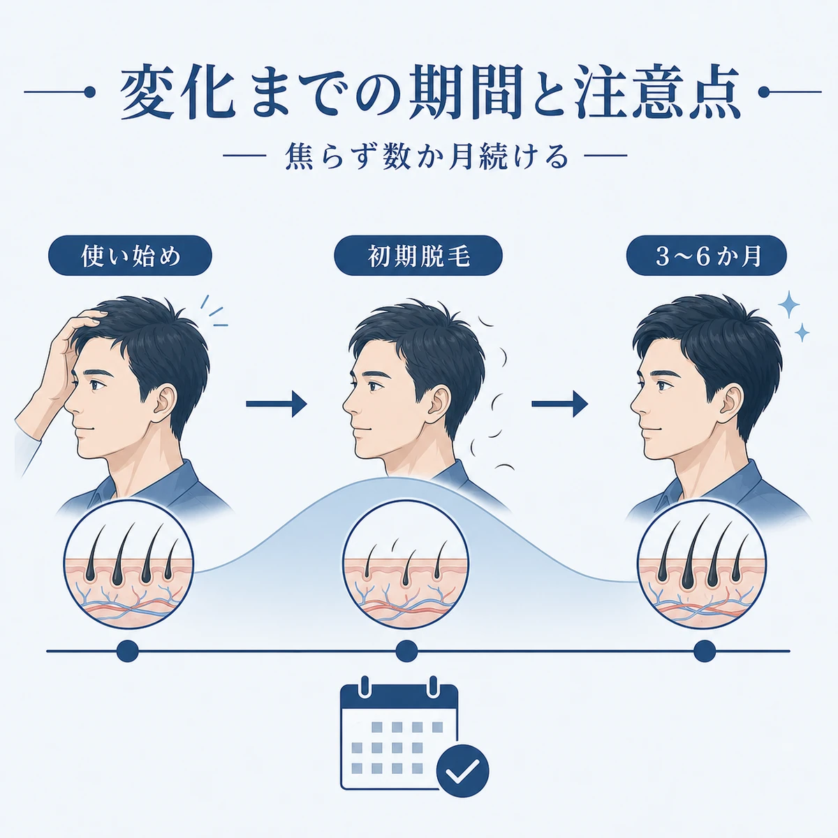 育毛剤を使い始めてから変化を感じるまでのヘアサイクルの期間と注意点を表したタイムラインの医療イラスト