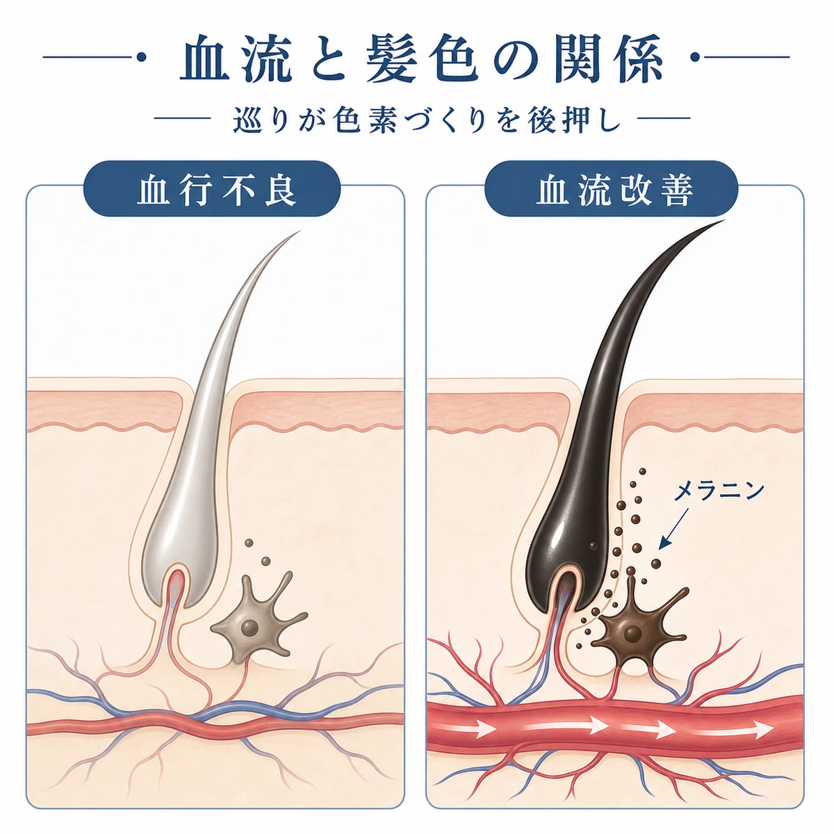 血流の状態によって色素細胞のはたらきが変わる様子を2パネルで対比した医療イラスト