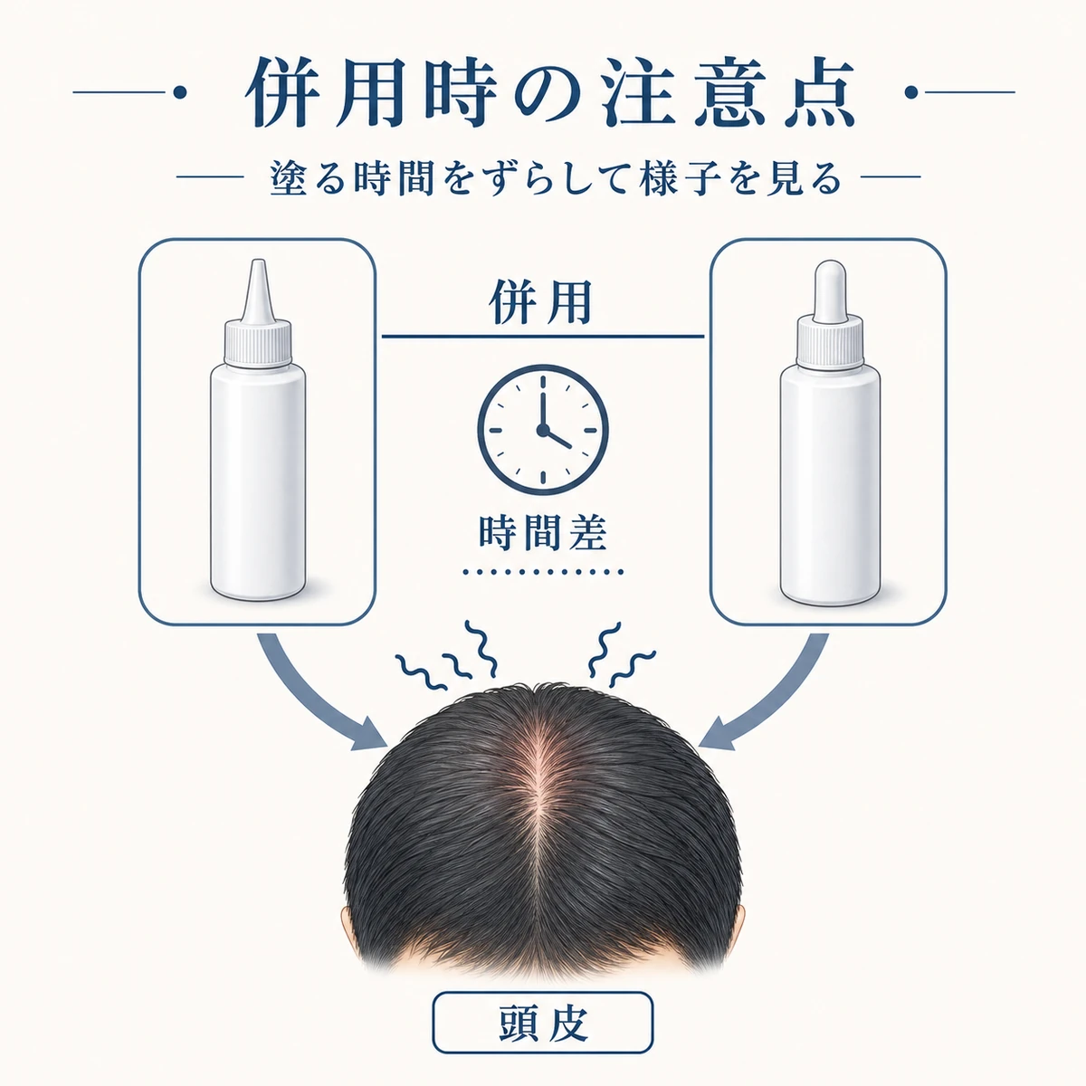 複数の育毛成分を併用する際の刺激と時間差ケアの注意点を表した医療イラスト