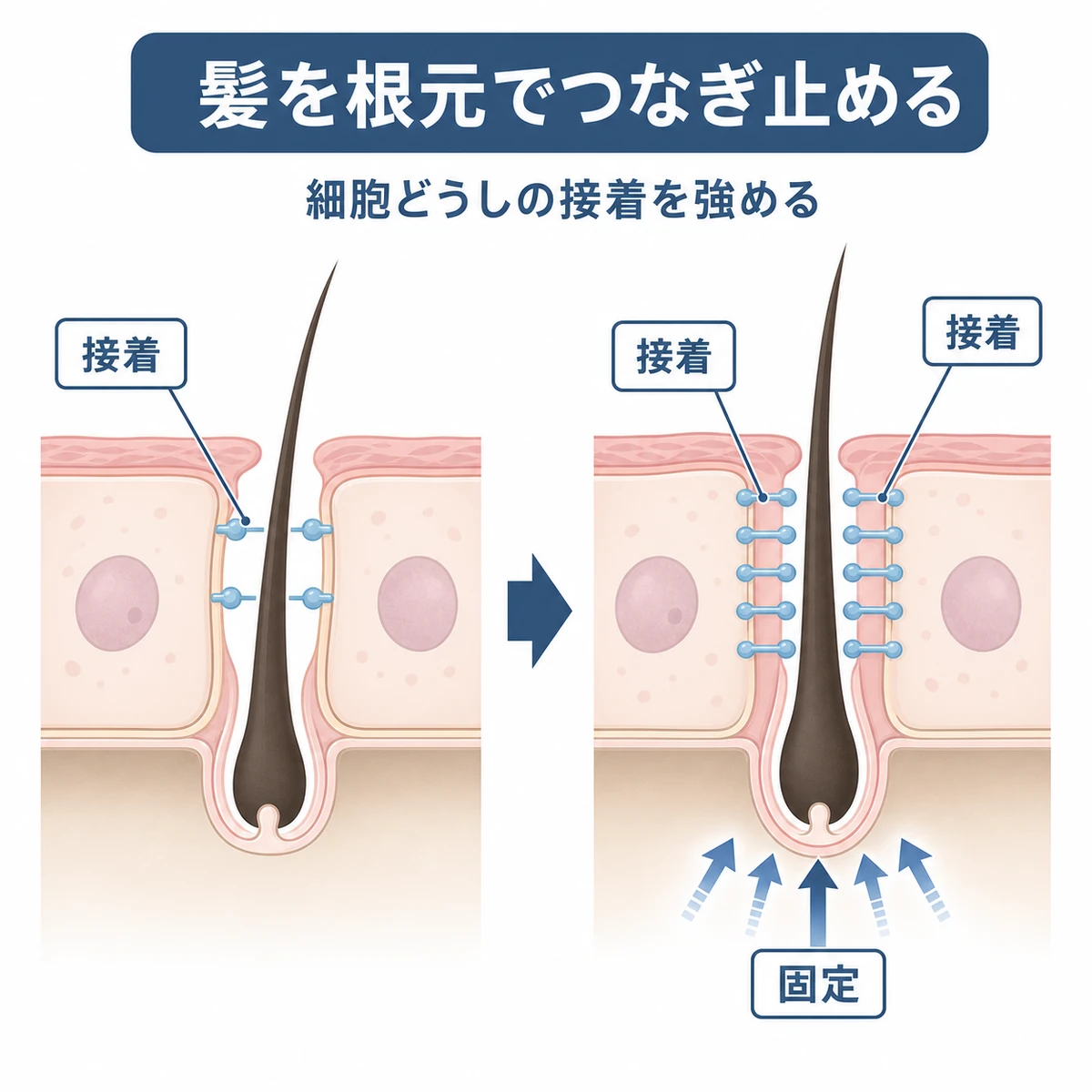 細胞の接着が強まり毛髪が根元で固定される仕組みを表した医療イラスト