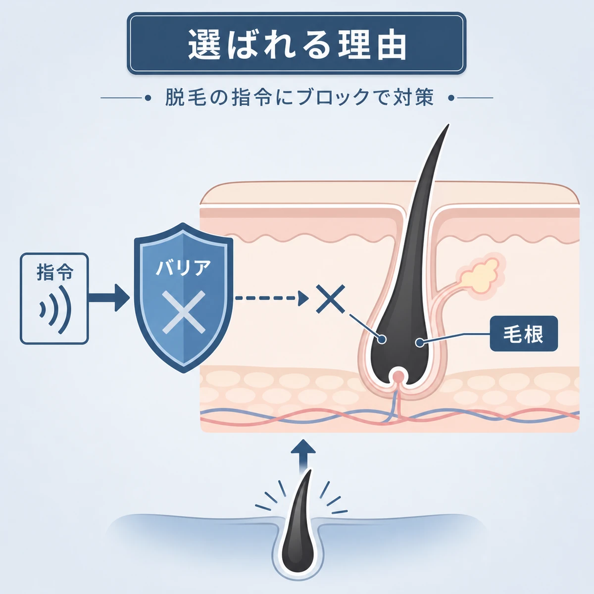 脱毛の指令をバリアで遮り毛根を守るt-フラバノンの働きを表した医療イラスト