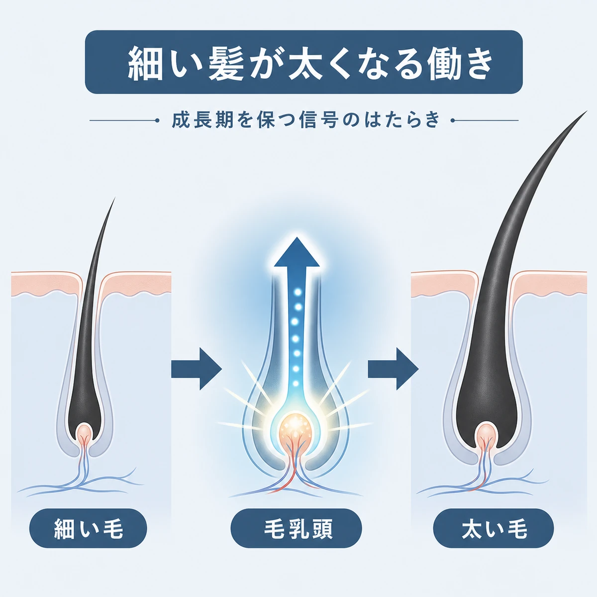 毛乳頭からの信号で細い髪が太く育つ段階を表した医療イラスト