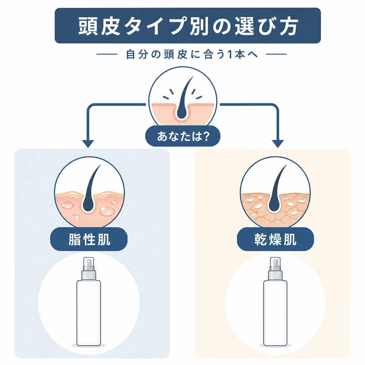 脂性肌と乾燥肌で育毛剤の選び方が分かれるしくみを表した医療イラスト