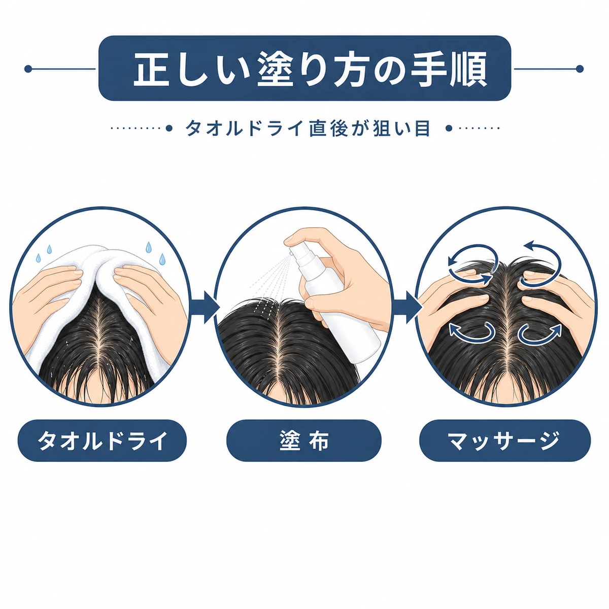 洗髪後から塗布とマッサージまでの育毛剤の正しい使い方の流れを表した医療イラスト