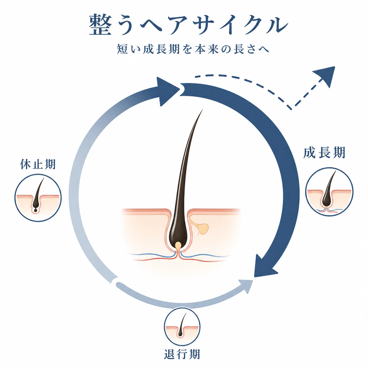 ヘアサイクルの成長期が本来の長さへ戻り整う流れを表した医療イラスト