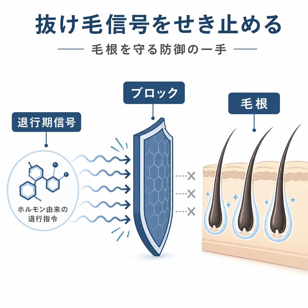 毛根の成長を止める退行期の信号を盾でせき止めるt-フラバノンの防御的な働きを表した医療イラスト