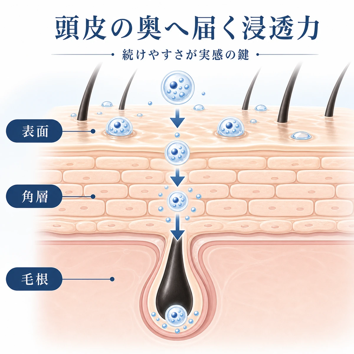育毛成分の微細な粒が頭皮の表面から角層を通り毛根の奥まで浸透していく過程を表した医療イラスト