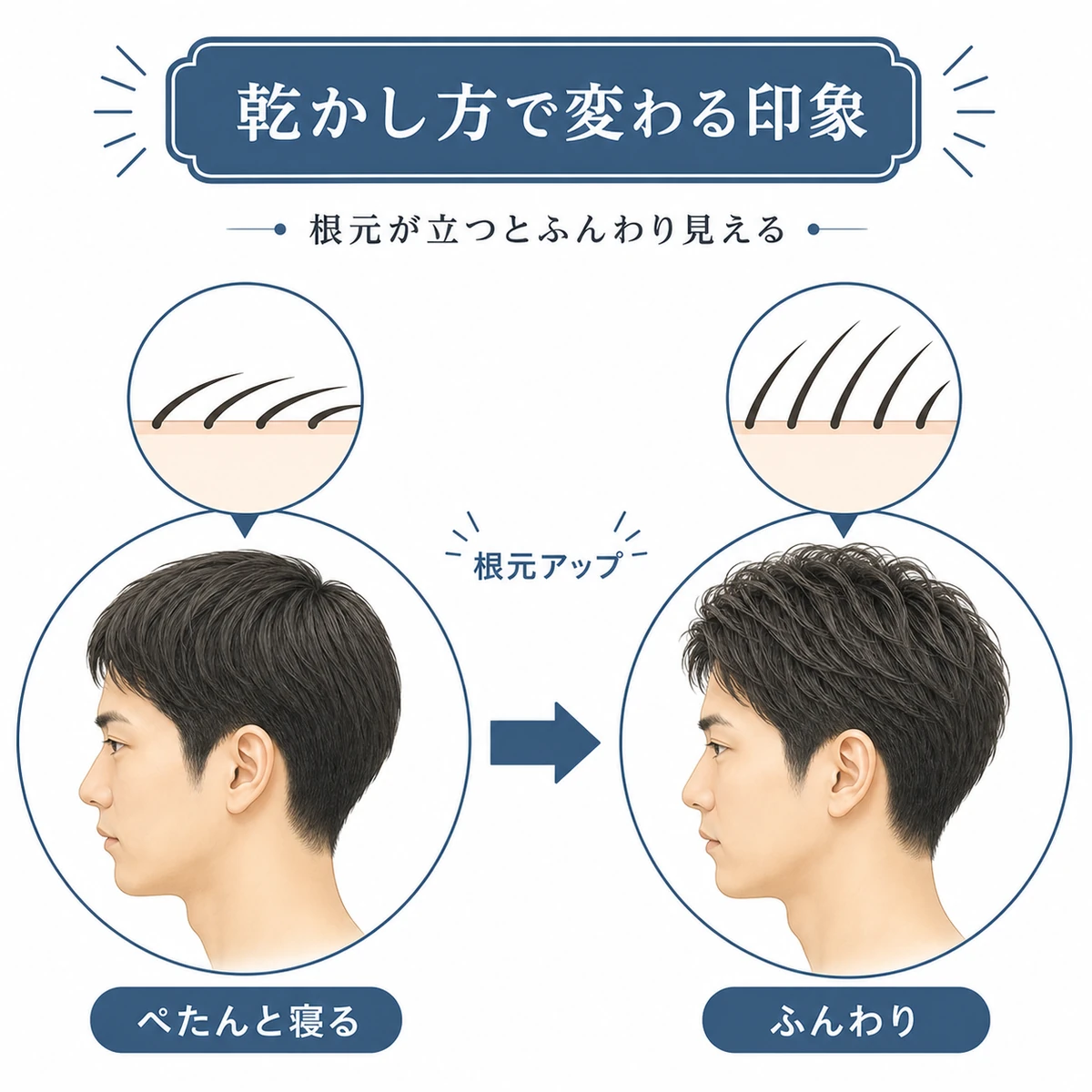 自然乾燥と根元を立ち上げた乾かし方で頭のシルエットが変わる違いを表した医療イラスト