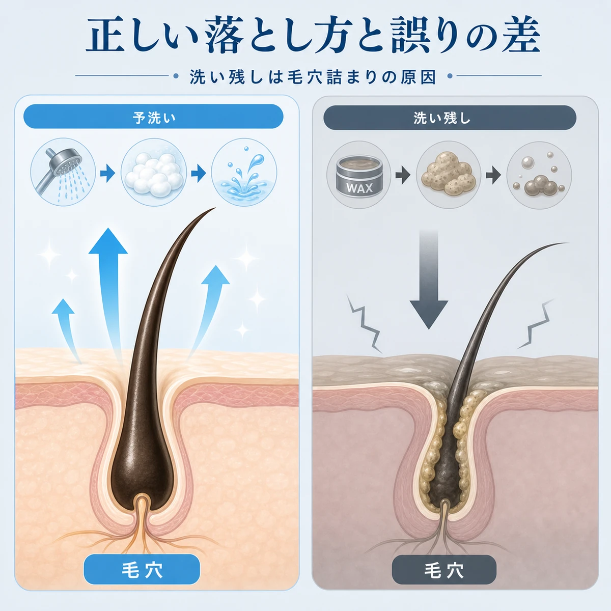 ワックスの正しい落とし方と洗い残しによる毛穴詰まりを対比した頭皮断面イラスト