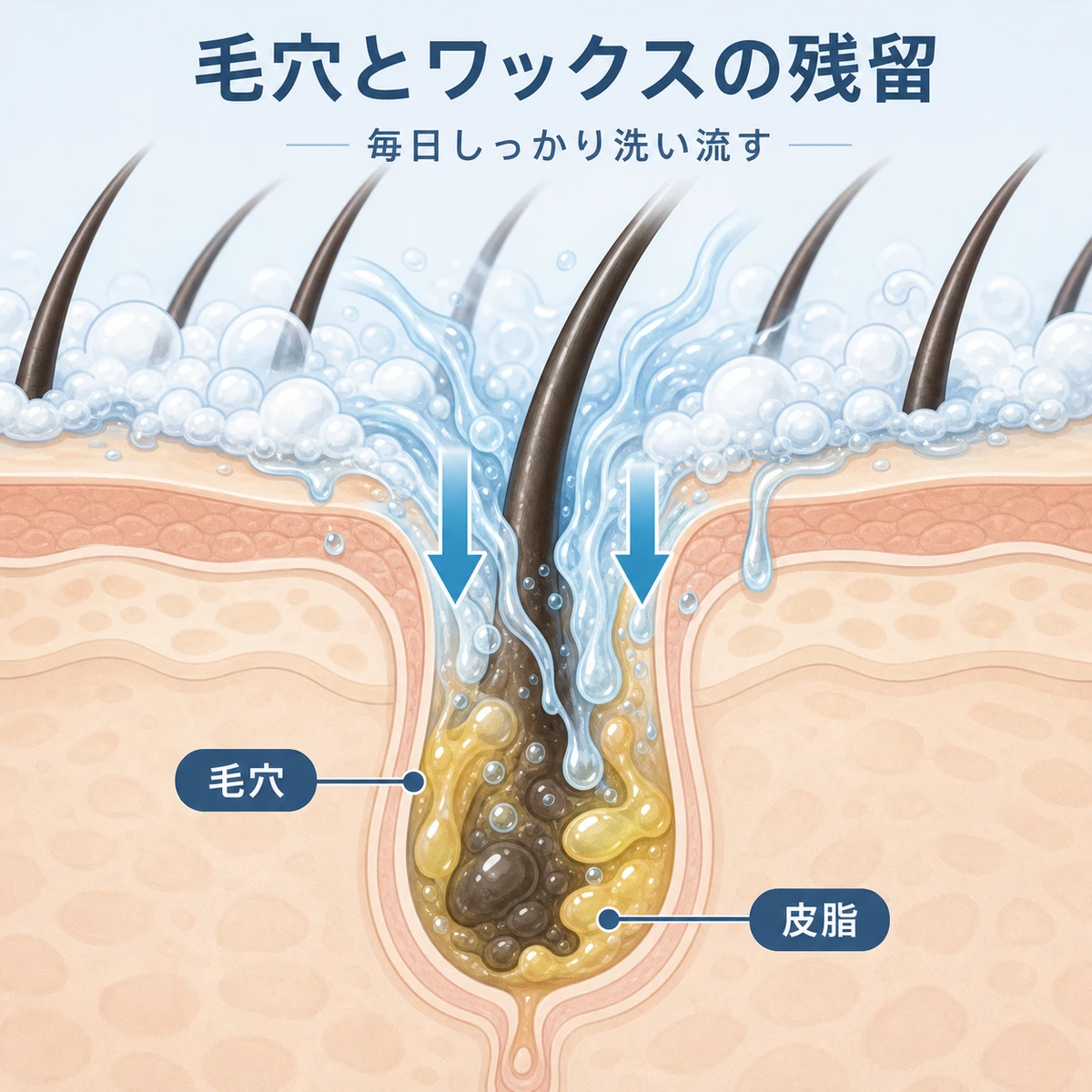 頭皮の断面で毛穴に残ったワックスを洗い流す仕組みを表した医療系イラスト