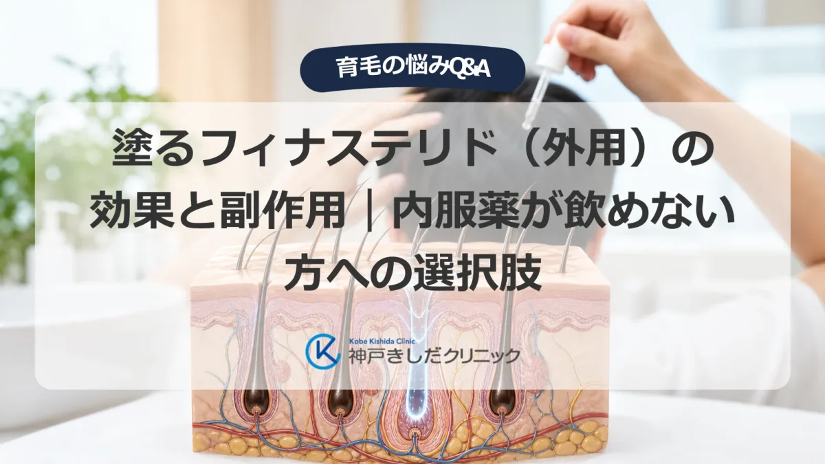 頭皮に外用薬を塗る男性の後ろ姿と毛包の断面イラスト