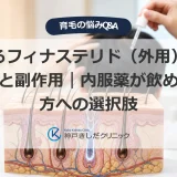 頭皮に外用薬を塗る男性の後ろ姿と毛包の断面イラスト