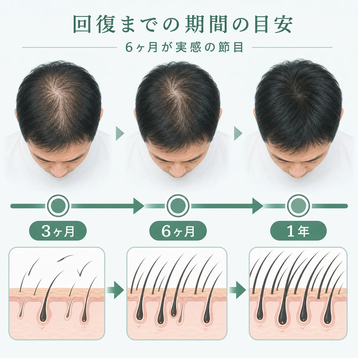 治療開始から1年までの回復の目安を段階的に示した医療イラスト