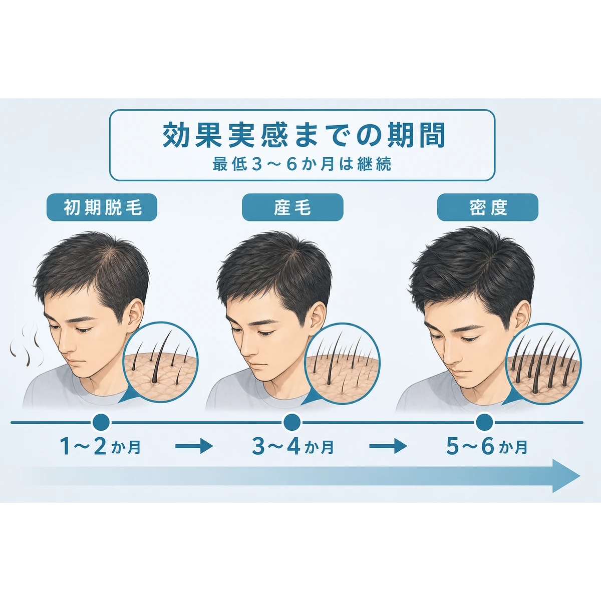 育毛剤使用開始から数か月の頭皮変化の目安を時系列で表した医療イラスト