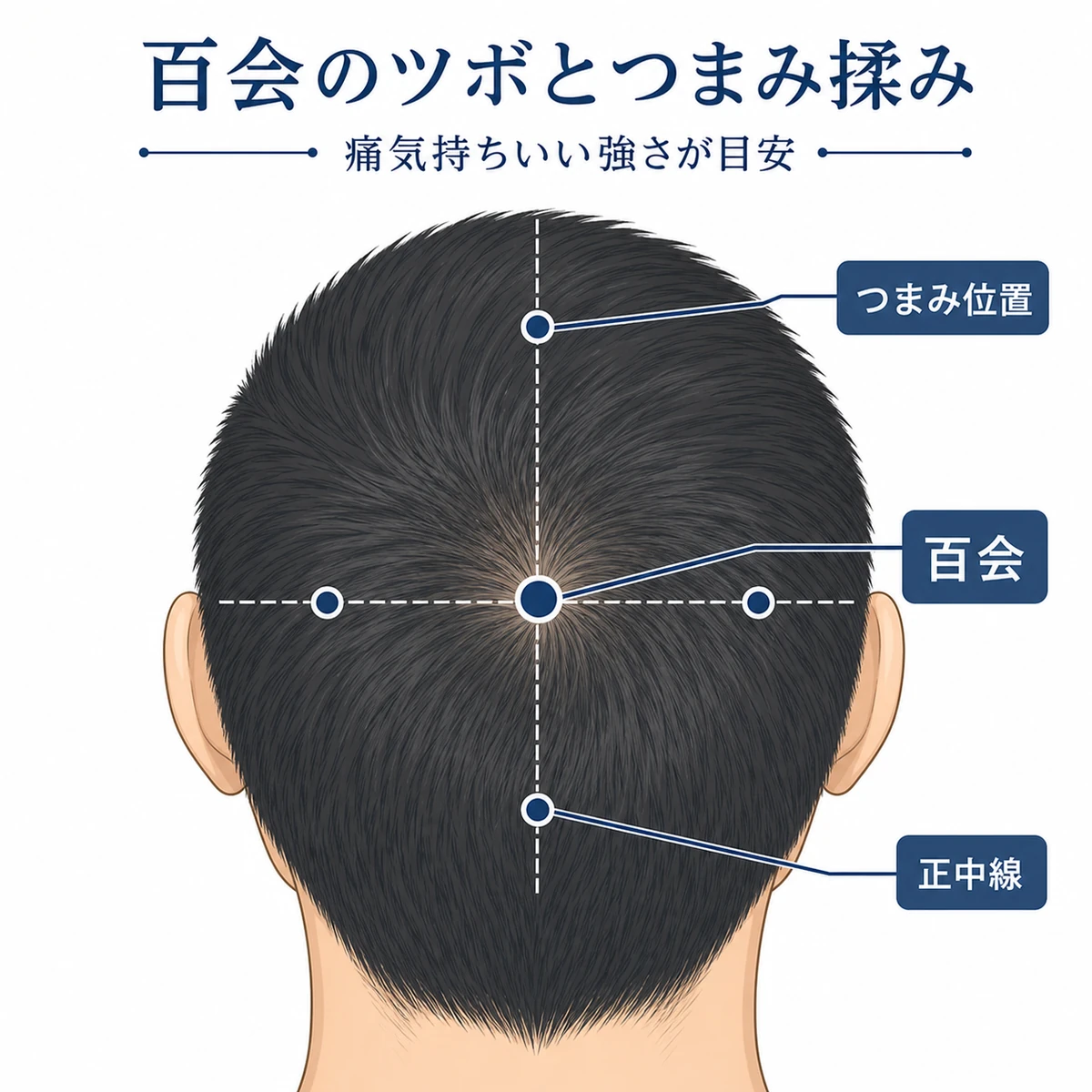 頭頂部を真上から見て百会のツボ位置とつまみ揉みを行う四カ所を示した頭皮マッサージのイラスト