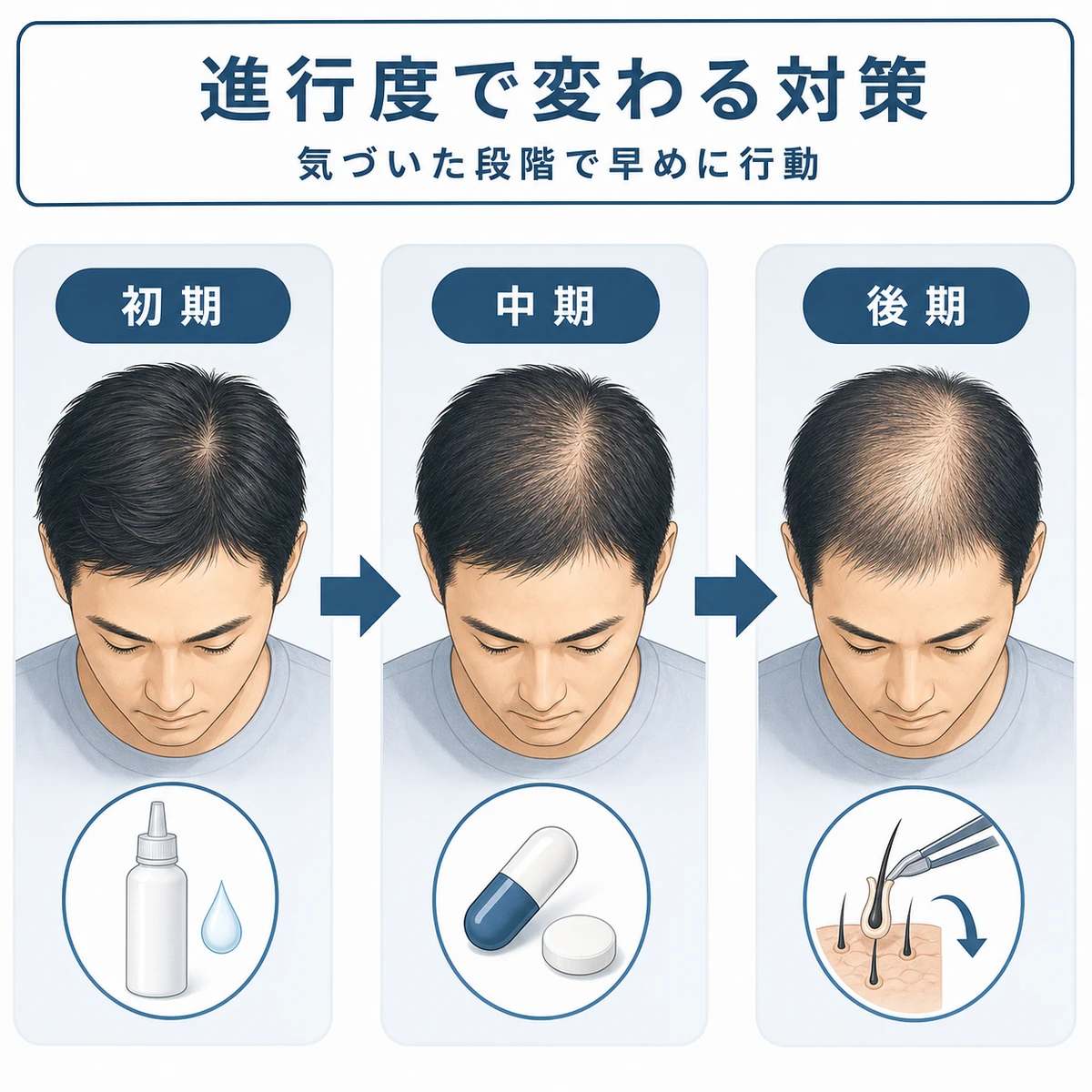 初期から後期まで進行度別の対策を左から右へ矢印で並べた医療イラスト