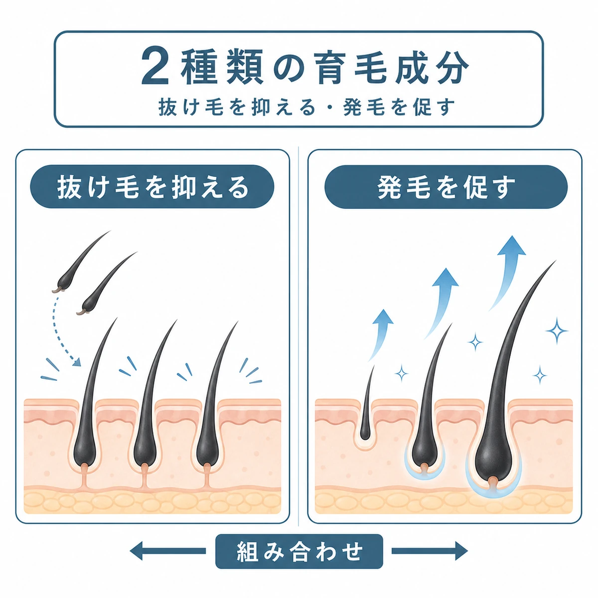 抜け毛を抑える成分と発毛を促す成分の違いを左右で比べた育毛イラスト