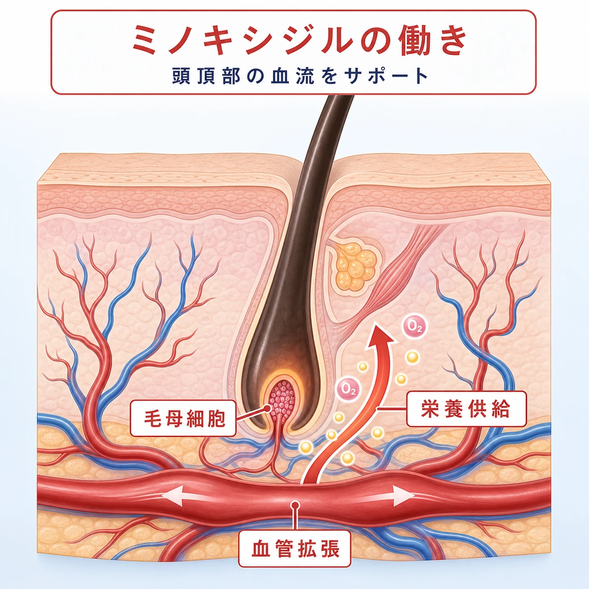 ミノキシジルが頭皮の血管を広げて毛根へ栄養を届ける断面のしくみを表した医療イラスト