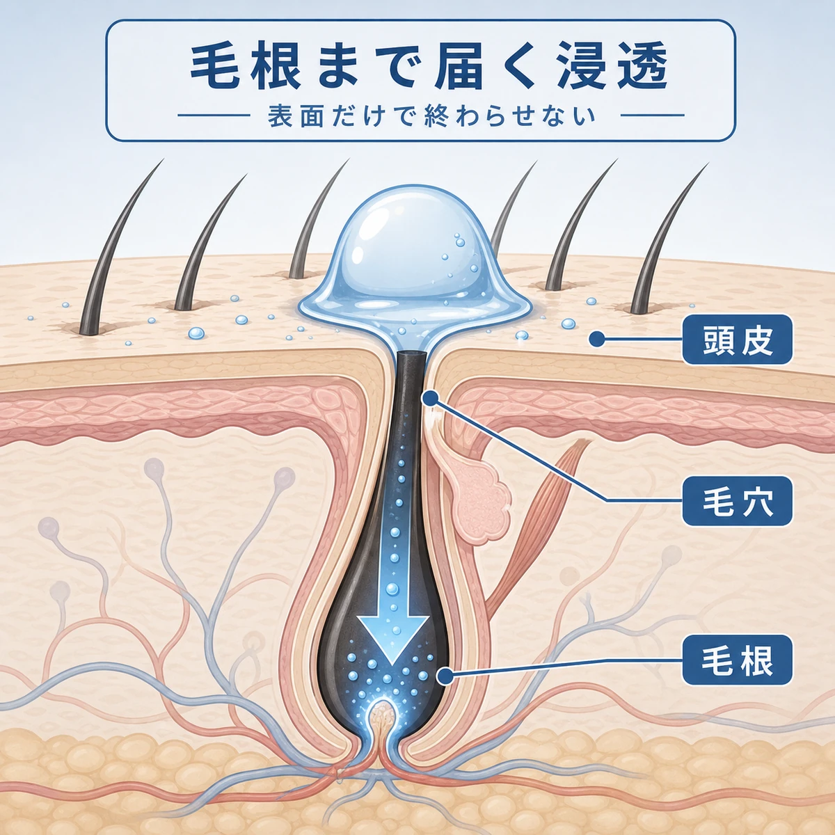 育毛剤が毛穴を通って毛根まで届く頭皮の断面を表した医療イラスト