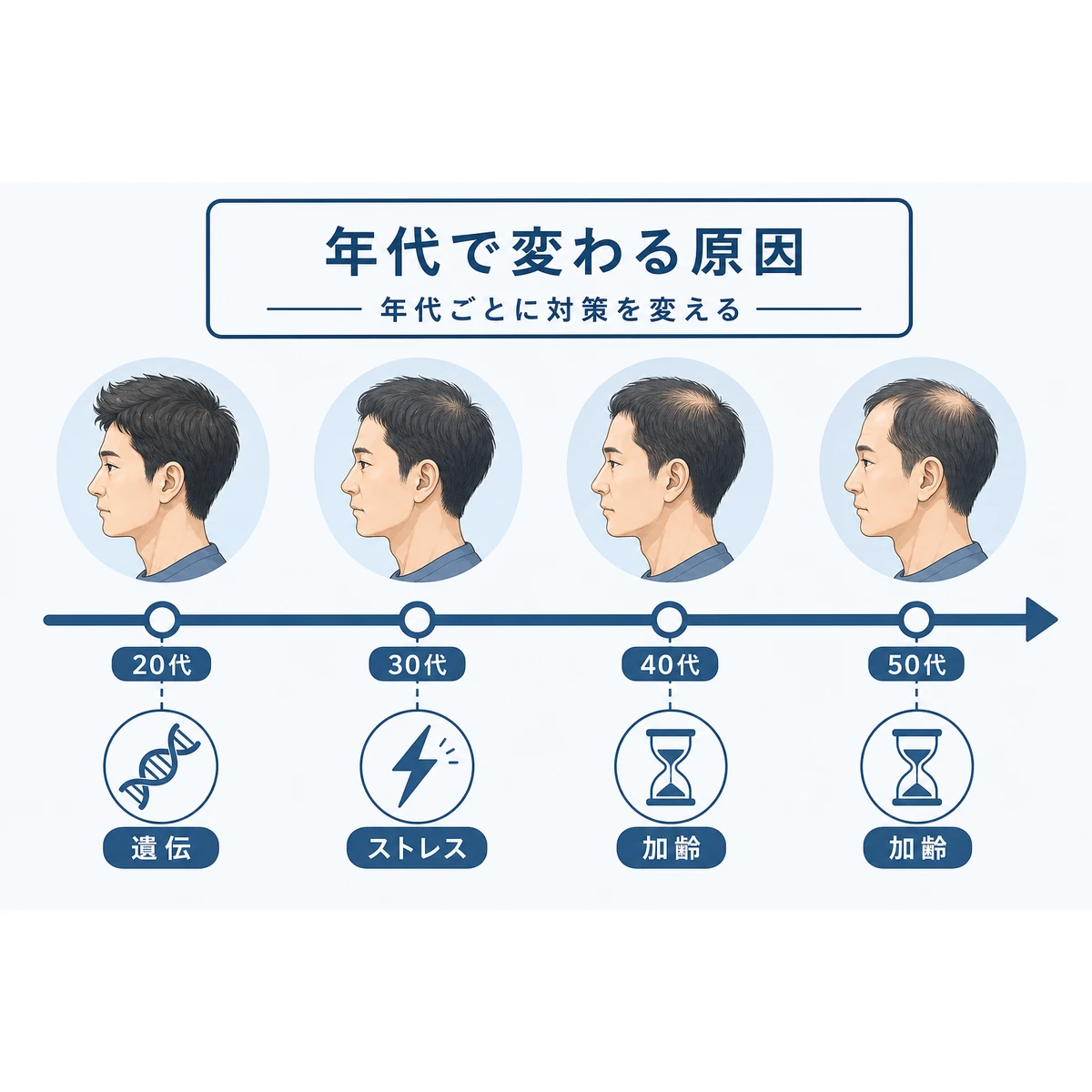 20代から50代まで年代ごとにつむじはげの原因が変わる流れを表した医療イラスト
