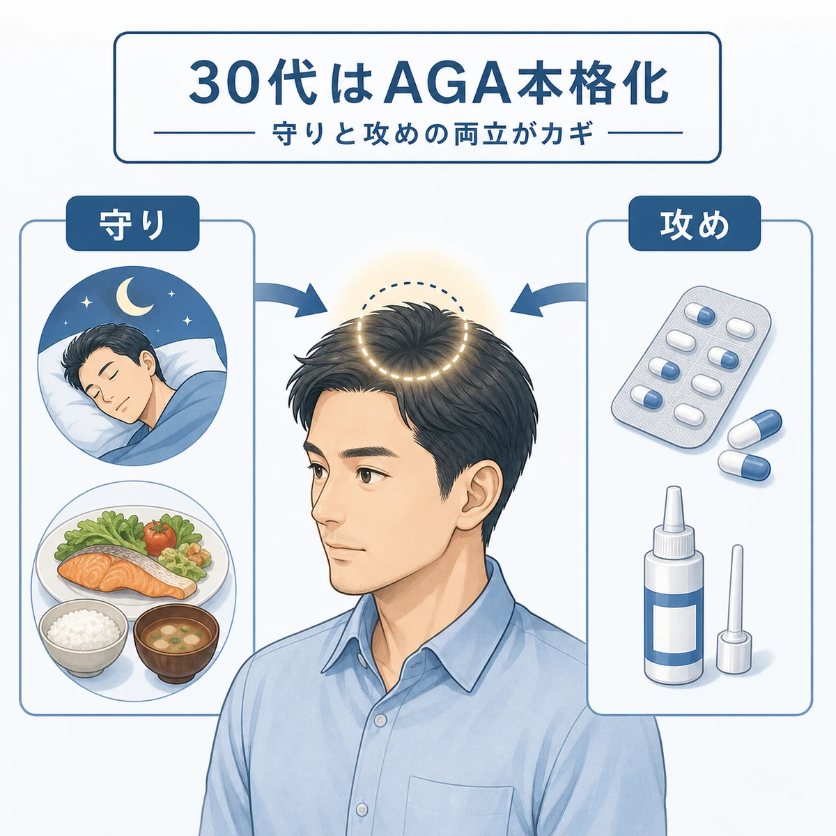 30代で本格化するAGAに守りの生活改善と攻めの治療で向き合う様子を表した医療イラスト