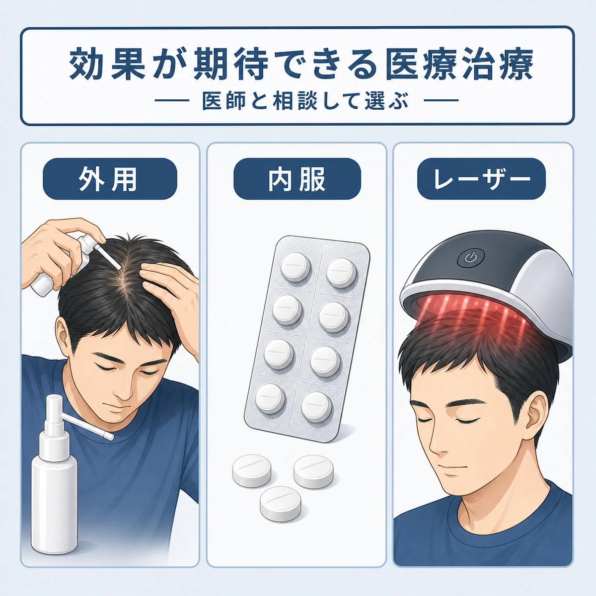つむじの薄毛に用いる外用薬や内服薬など主な医療治療を比べた医療イラスト