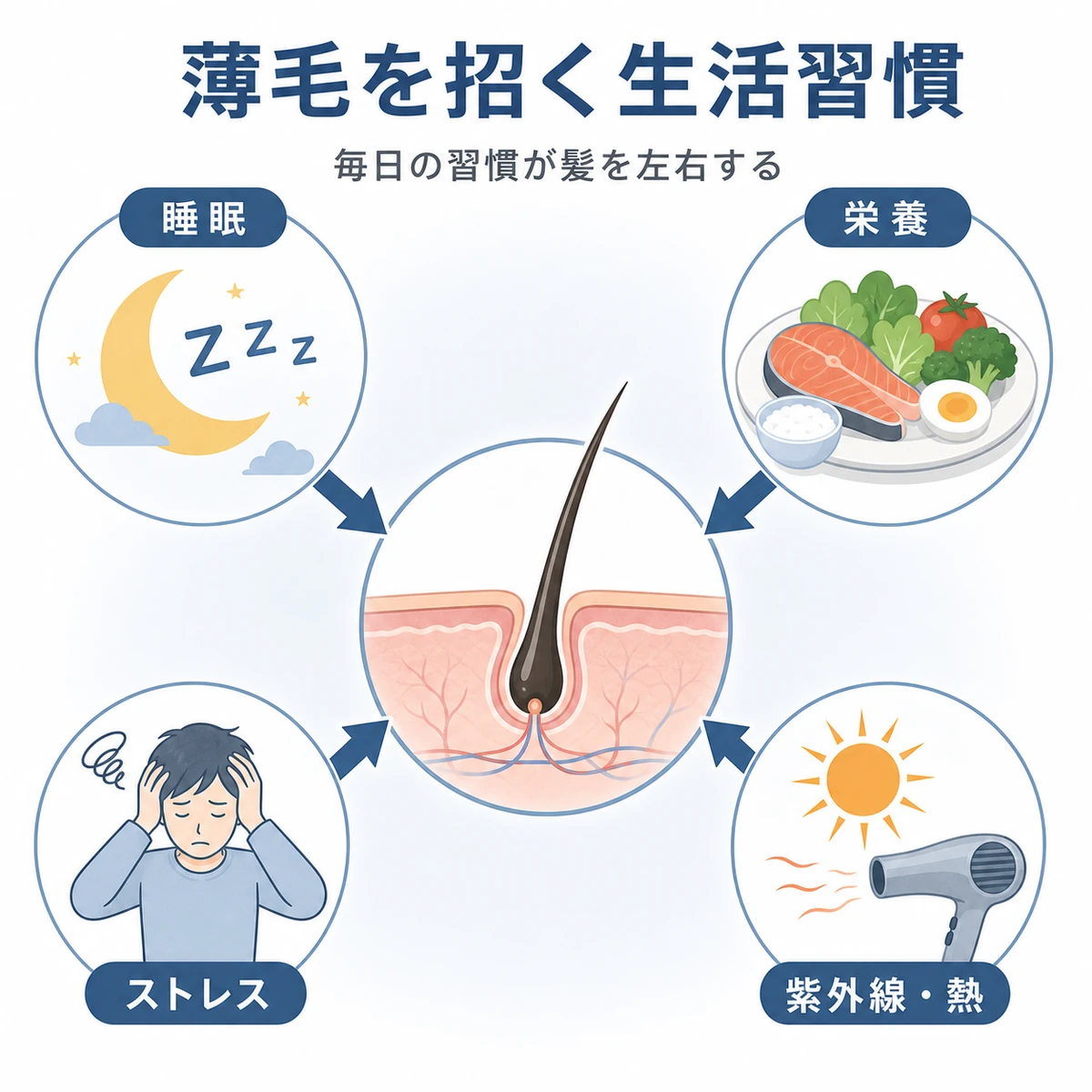 睡眠や栄養やストレスなどの生活習慣が毛根に影響する関係を表した医療イラスト