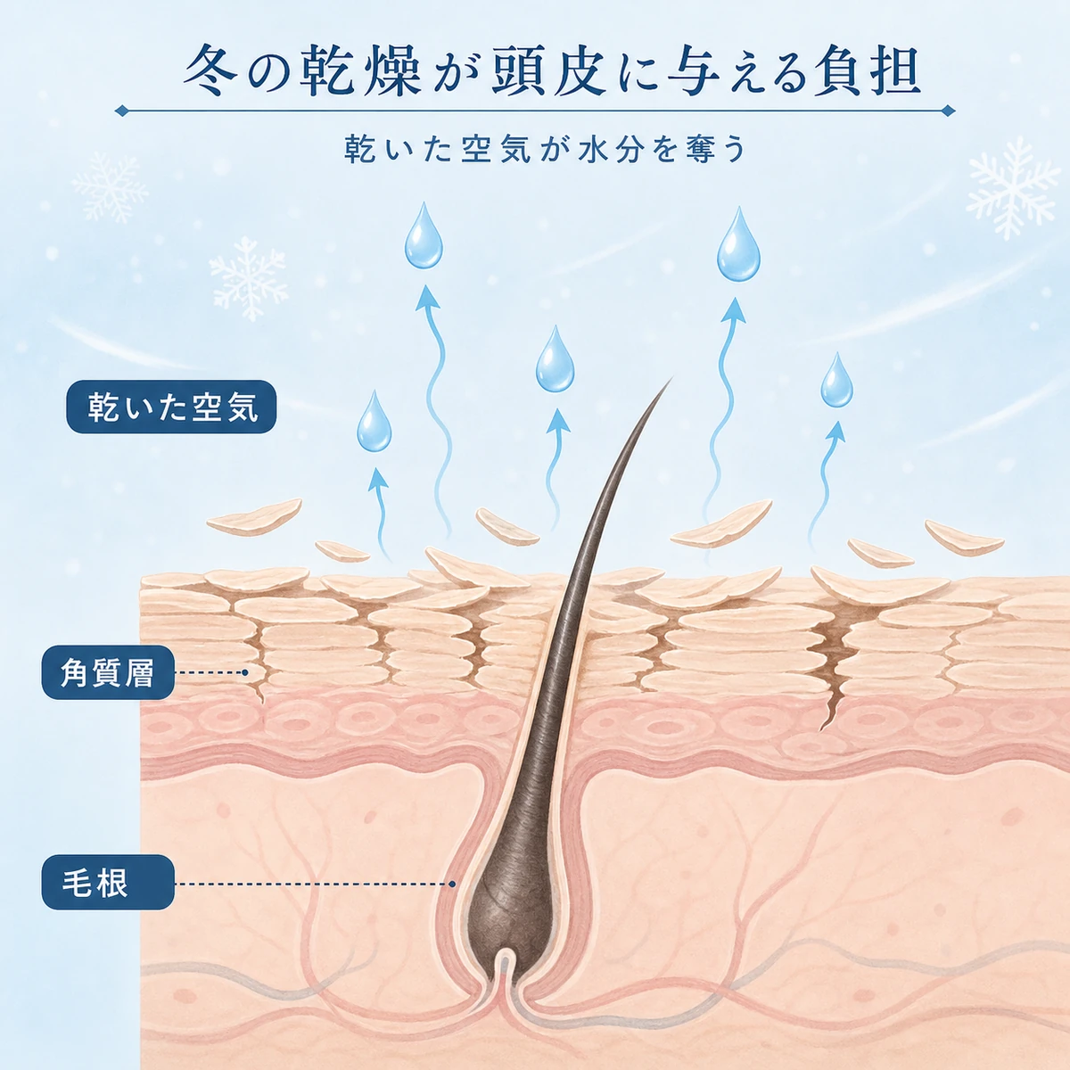 冬の乾いた空気が頭皮の角質層から水分を奪い毛根を弱らせる断面のしくみを表した医療イラスト