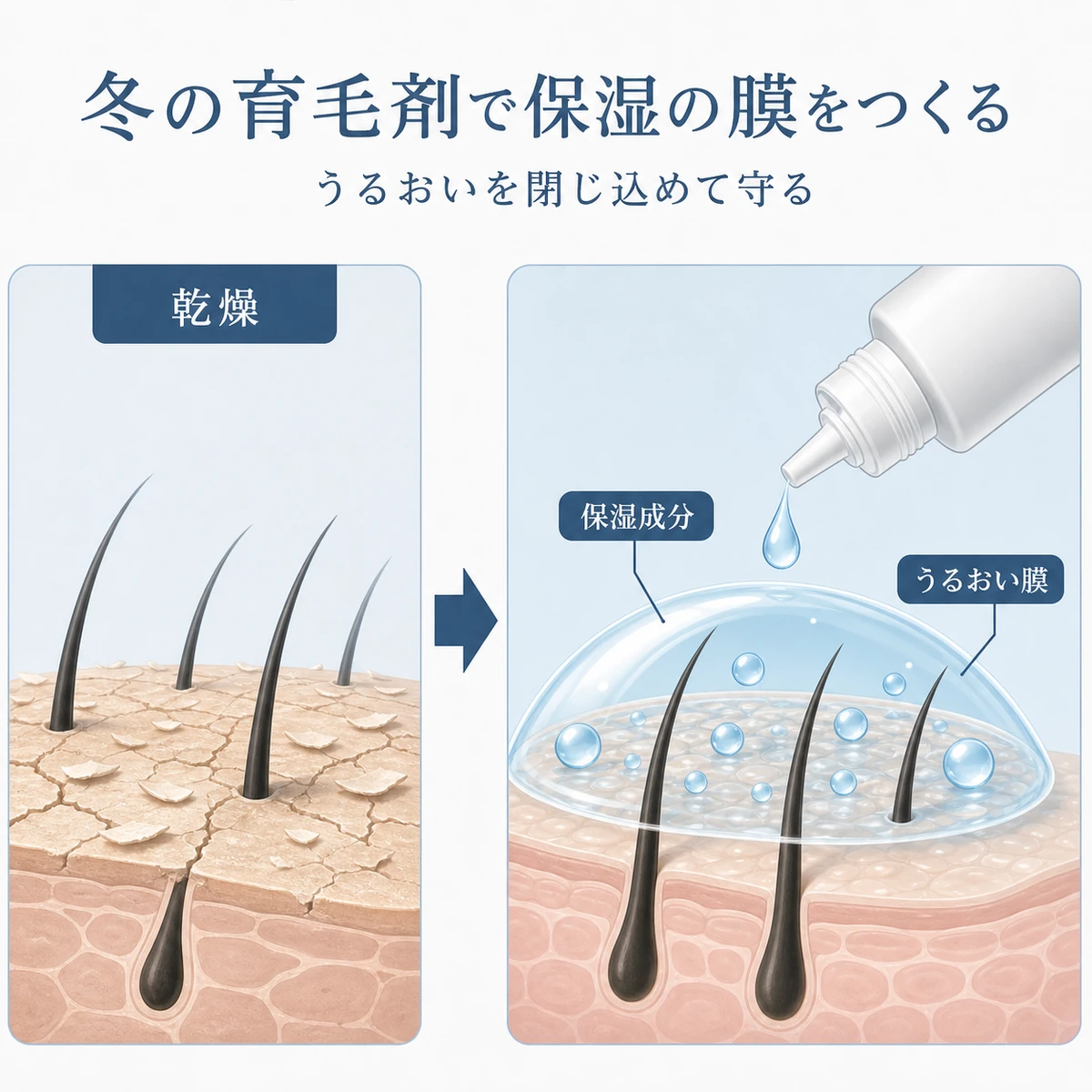育毛剤の保湿成分が乾いた頭皮にうるおいの膜をつくり水分を守る変化を表した医療イラスト