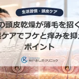 冬の頭皮乾燥が薄毛を招く？保湿ケアでフケと痒みを抑えるポイント