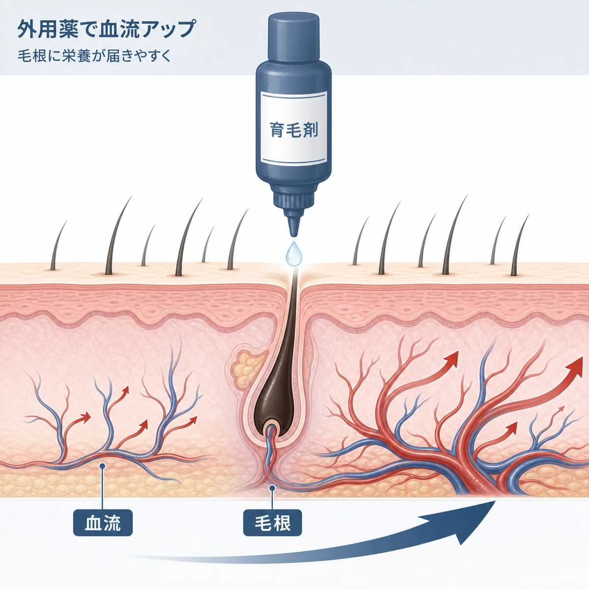 育毛剤の外用で頭皮の血流が増え毛根に栄養が届く様子を断面図で表した医療イラスト