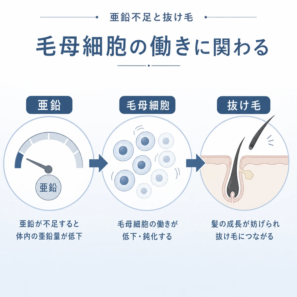 亜鉛の不足が毛母細胞の働きを弱め抜け毛につながる流れを表した医療イラスト