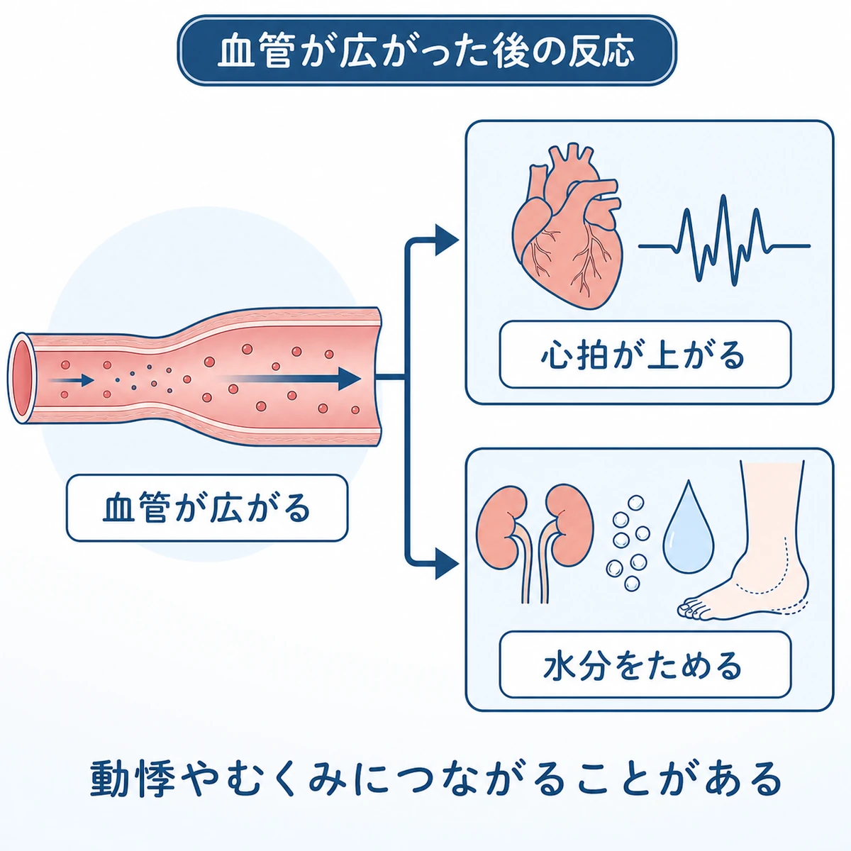ミノキシジルで血管が広がった後に心拍増加と水分保持へ分かれて動悸やむくみにつながる仕組みを表した医療図解