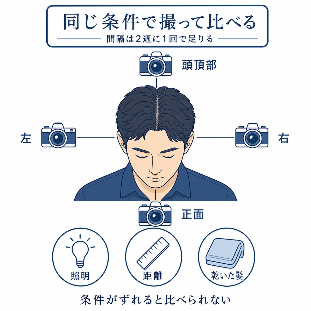 正面と頭頂部と左右の4方向を同じ照明と距離で撮り比べる記録の取り方を表した図解