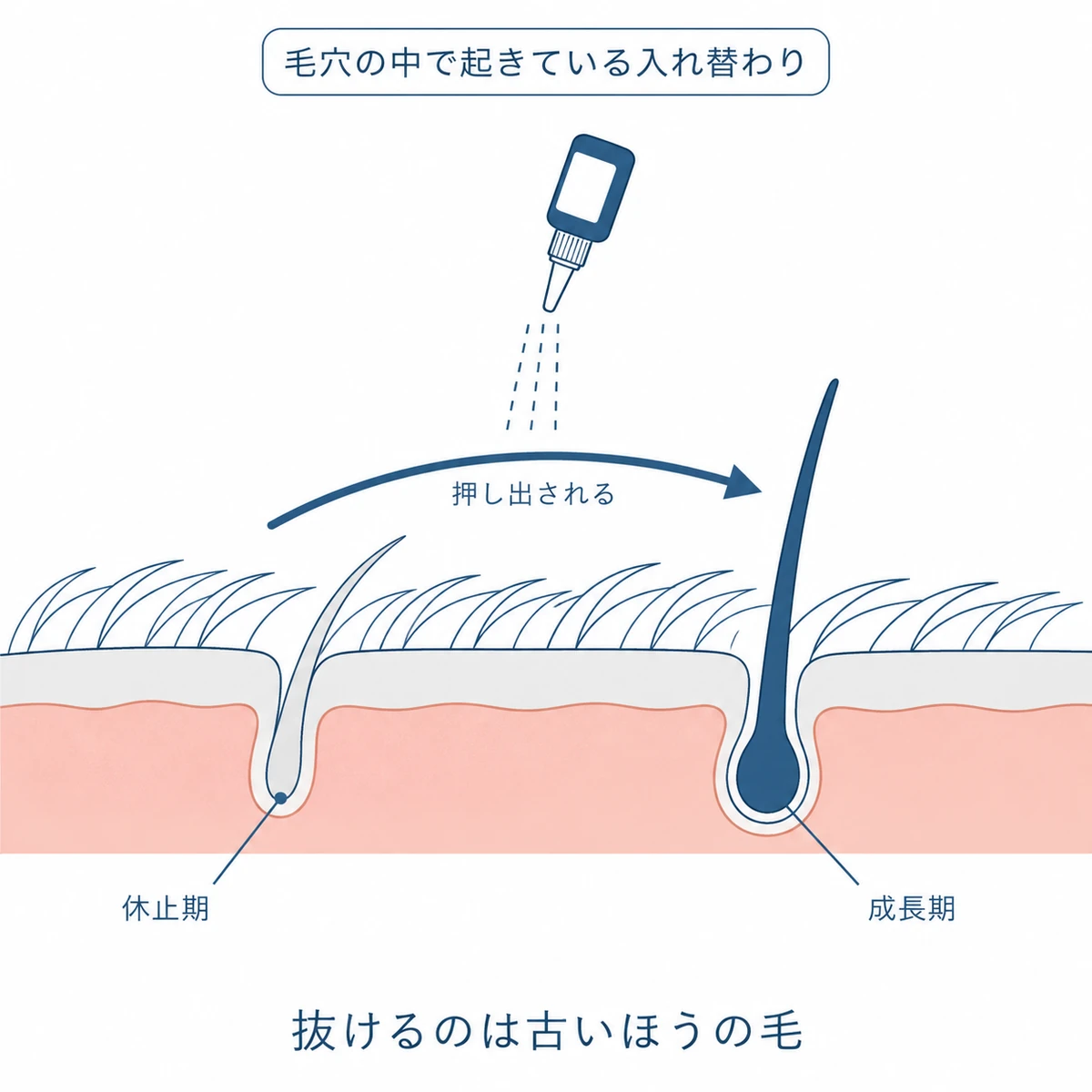 育毛剤の使用で休止期の古い毛が成長期の毛に押し出される毛周期の切り替わりを表した頭皮の断面図