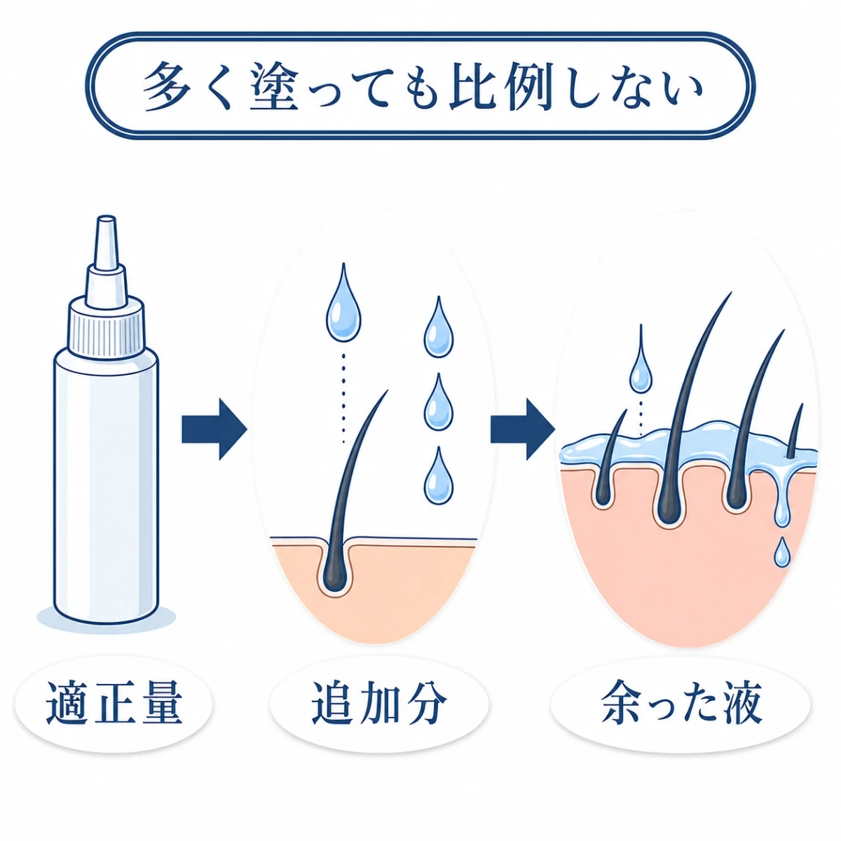 育毛剤の適正量へ追加しても効果は比例せず余った液が頭皮や髪に残る関係を示す図解