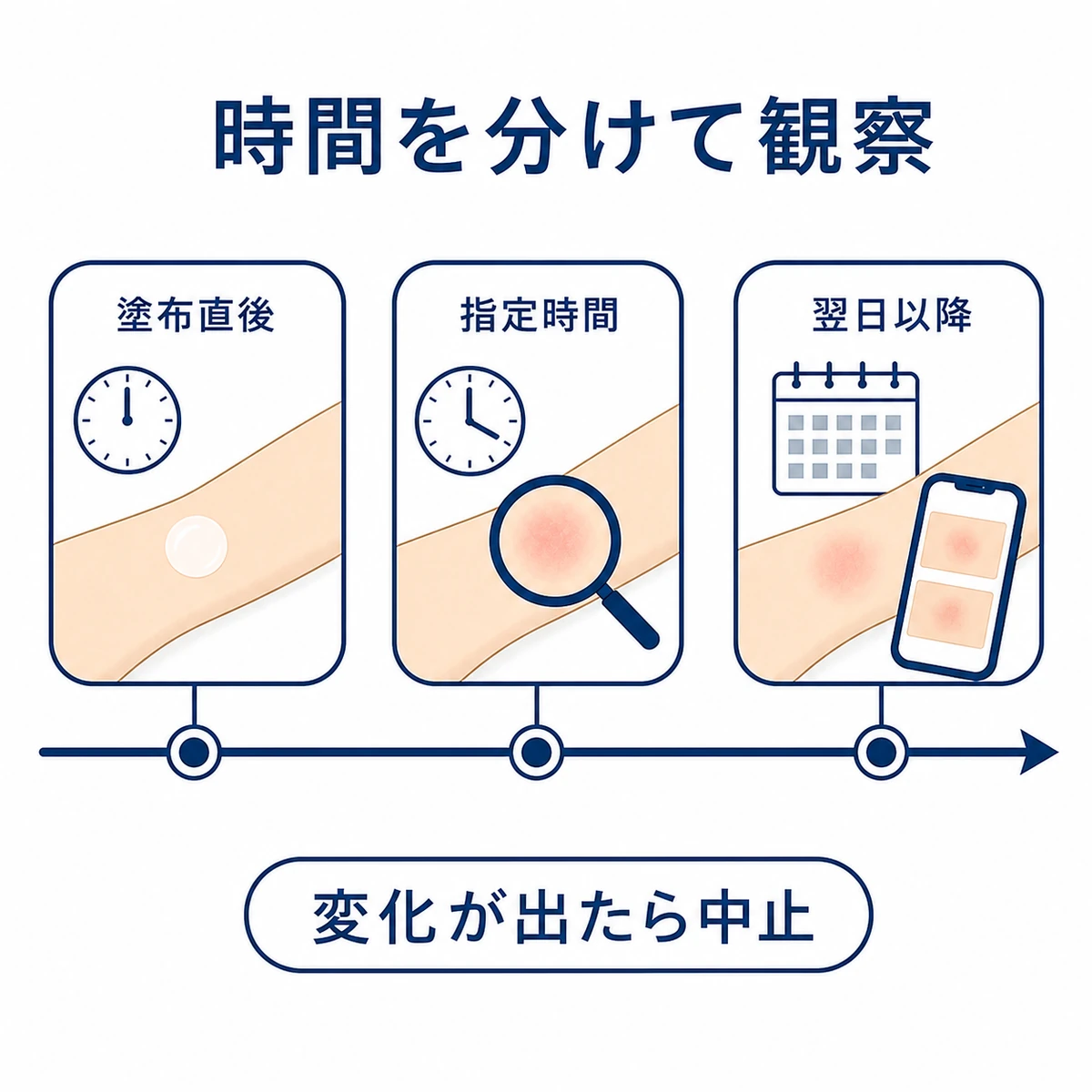 育毛剤のパッチテストを塗布直後と指定時間と翌日以降に分けて観察する時間軸の図解