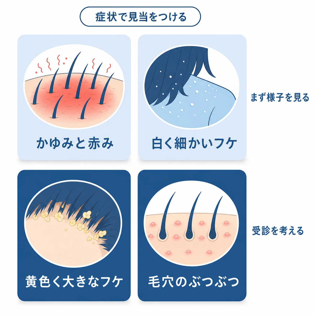 育毛剤で出るかゆみと赤み白く細かいフケ黄色く大きなフケ毛穴のぶつぶつの4つを様子見と受診に仕分けた図解
