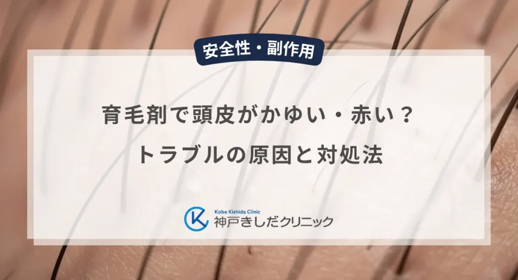 育毛剤で頭皮がかゆい・赤い？トラブルの原因と対処法