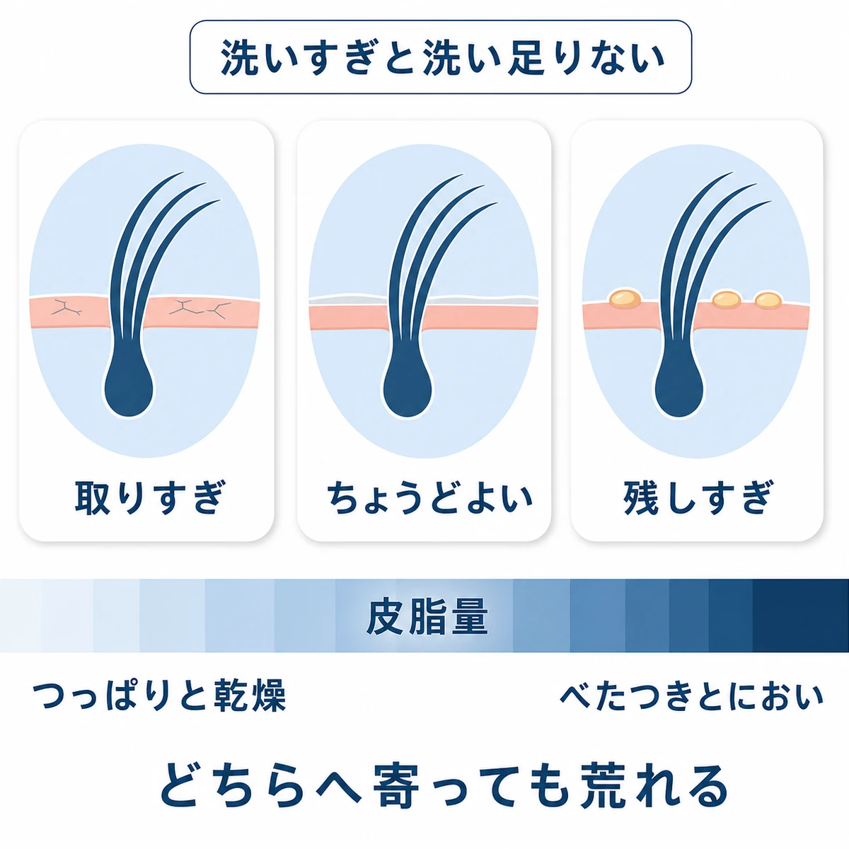 皮脂を取りすぎた頭皮、適度な状態、皮脂が残りすぎた頭皮を横並びで比較した図