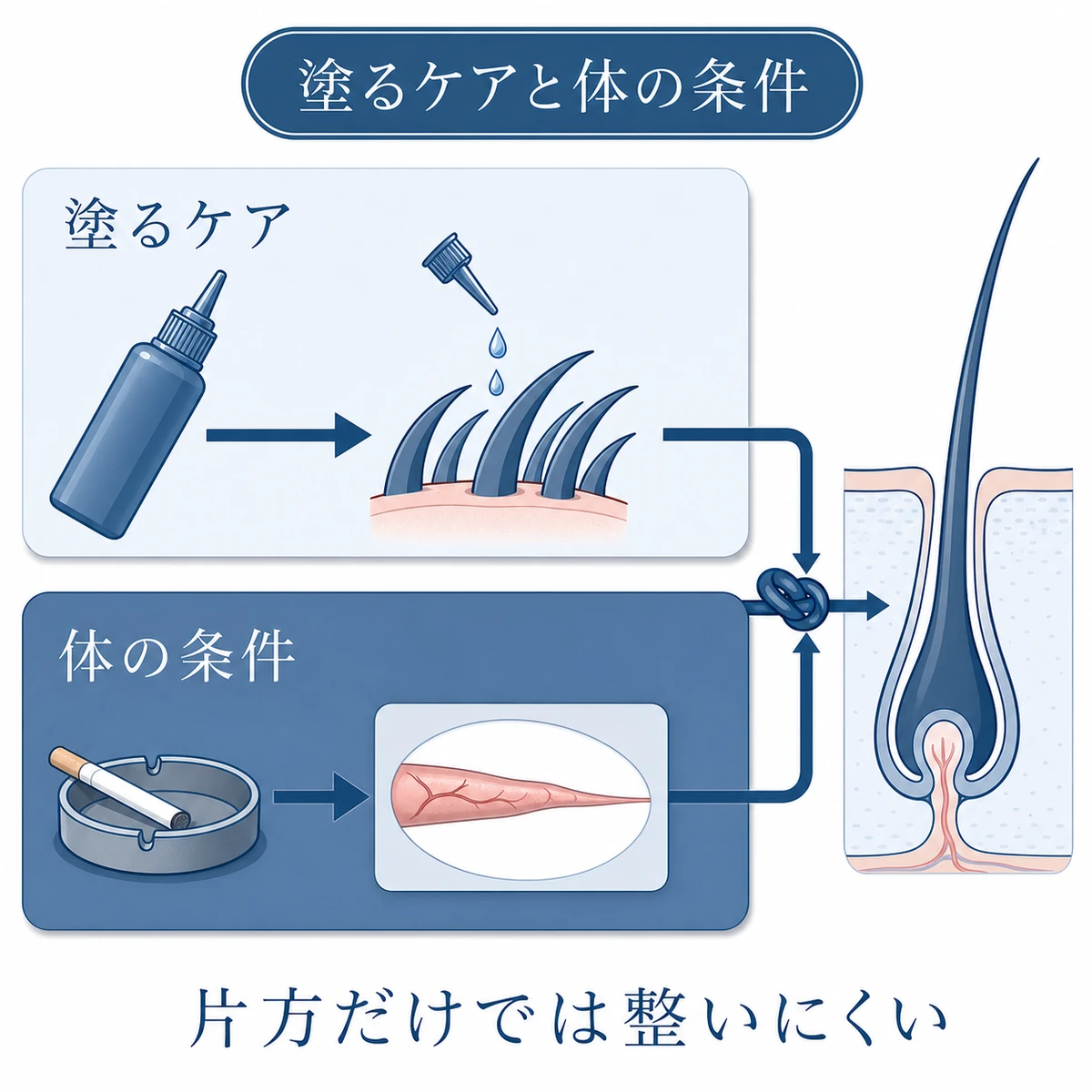 育毛剤を塗るケアと喫煙による体内の条件が毛包で合流する様子の図解