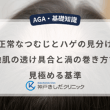 男性の正常なつむじとハゲの見分け方は？地肌の透け具合と渦の巻き方で見極める基準