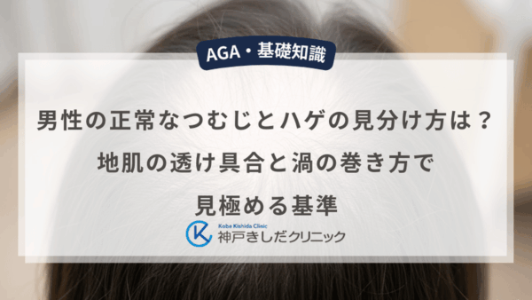 男性の正常なつむじとハゲの見分け方は？地肌の透け具合と渦の巻き方で見極める基準